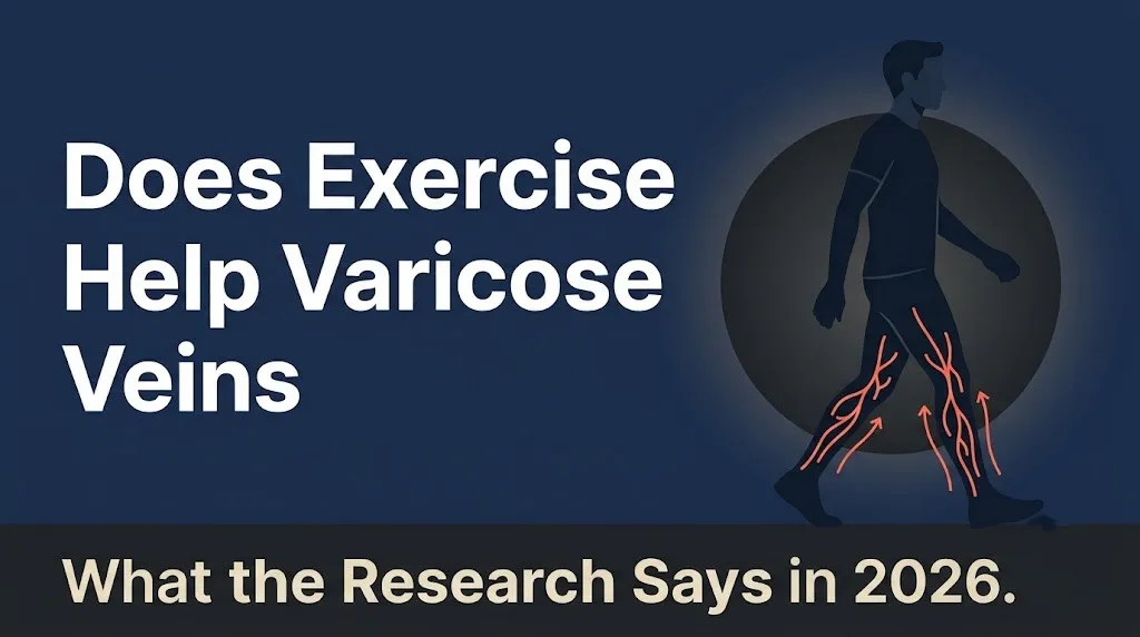 Illustrated banner showing does exercise help varicose veins with a walking silhouette and calf vein flow diagram in navy and orange.